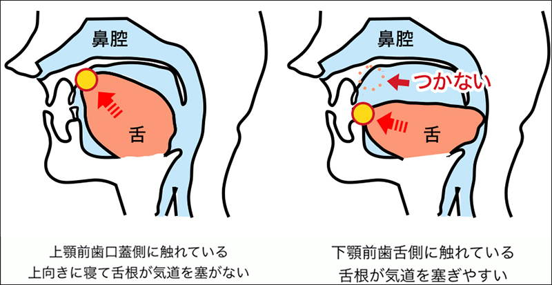 舌の位置が下がる「低位舌」 東京都中央区銀座オーク銀座歯科